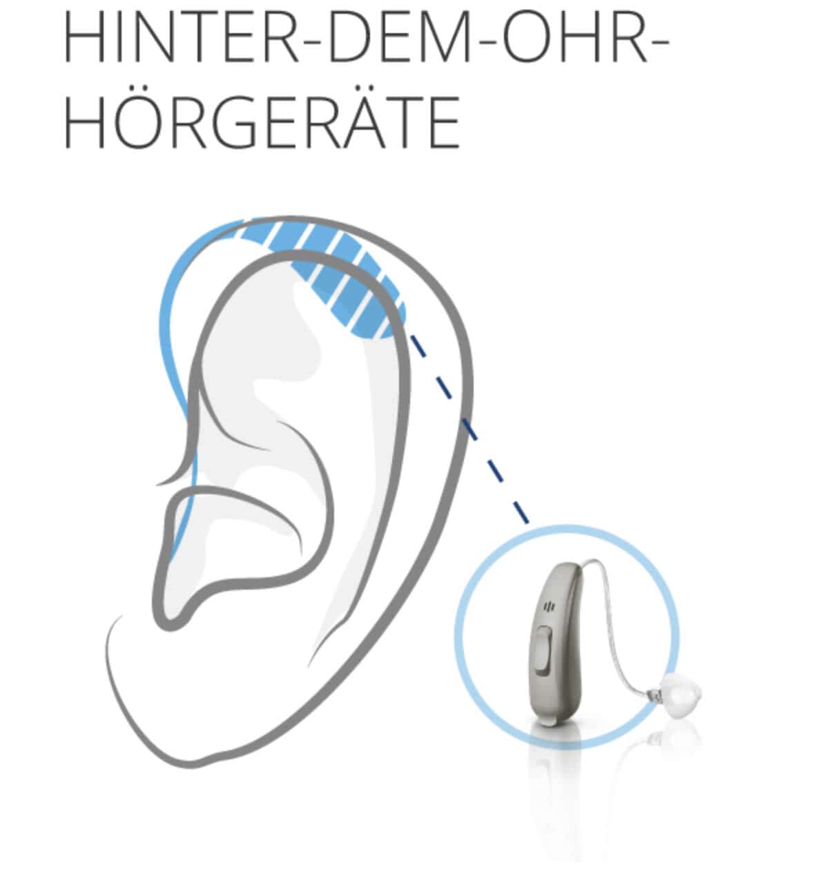hinter dem Ohr Hörgeräte