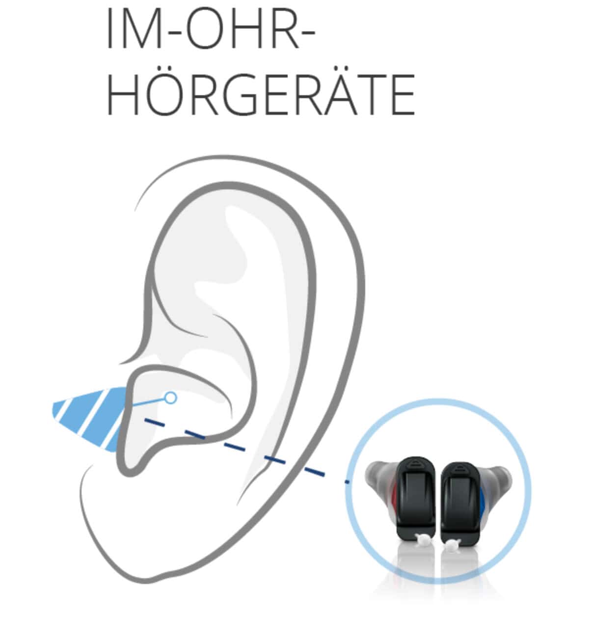Im Ohr Hörgeräte