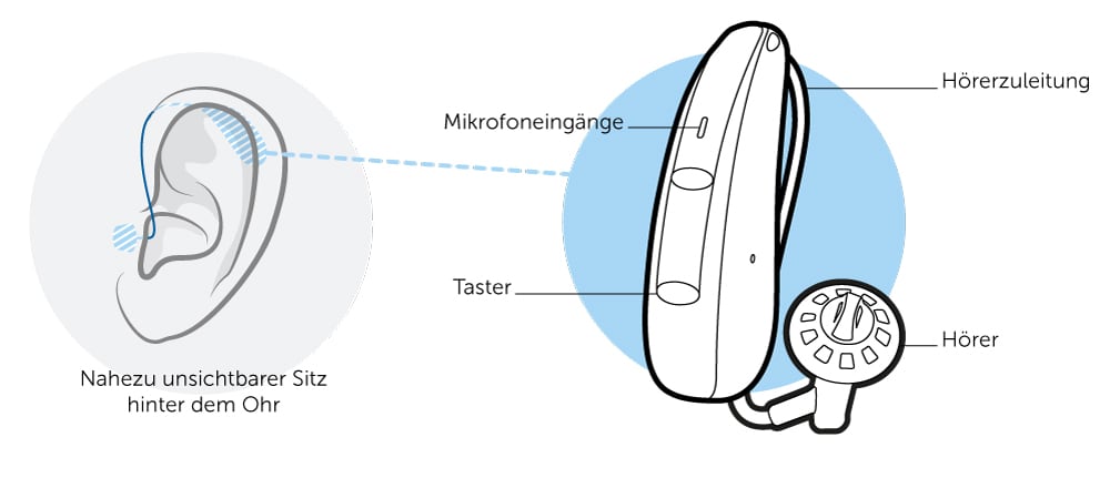 Hinter-dem-Ohr-Hörgerät Illustration