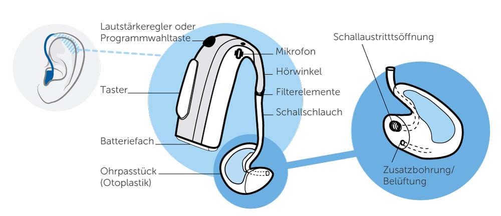 Hinter-dem-Ohr-Hörgerät mit Schallschlauch Illustration