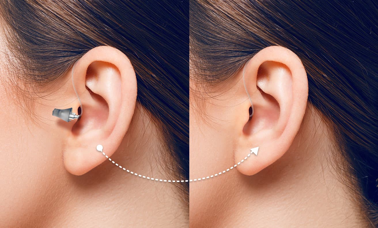 https://www.audibene.de/wp-content/uploads/sites/2/2022/09/hdo_fitting.jpg